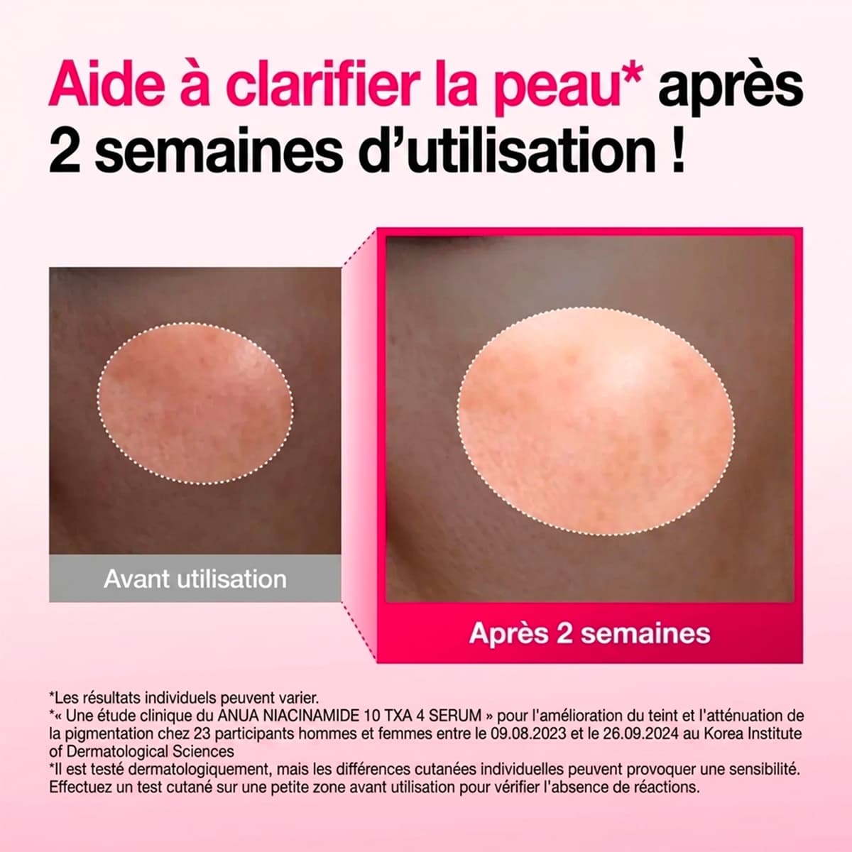 Sérum Niacinamide 10% + TXA 4%